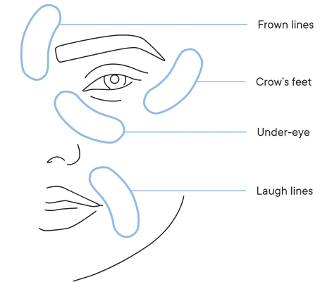 🔥Final 3 hours-60%OFF &Smooth, firm and plump stubborn areas with Microneedle Patch Targeted Patches